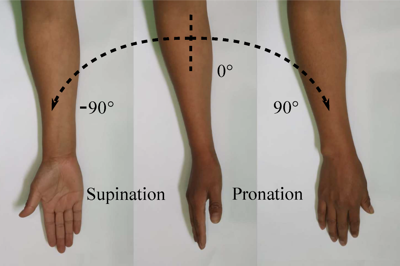 Forearm pronation